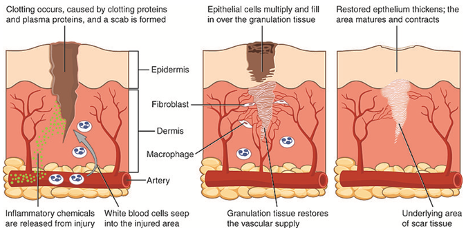 The 3 Phases of Wound Healing